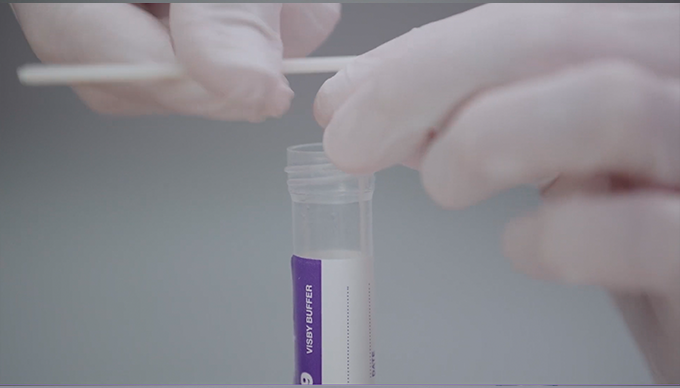 Chapter 3<br><b>Patient<br>sample in tube</b>